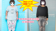 从不认识你到认不出你，减重女孩一年时间实现美丽蜕变——附属瑞康医院胃肠外科举行减重手术一周年纪念活动