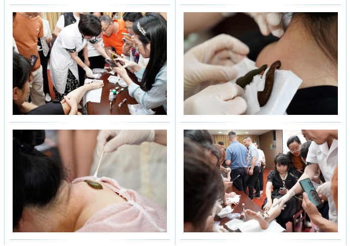 ▲壮医水蛭疗法实操及示范现场 ▲壮医水蛭疗法实操及示范现场