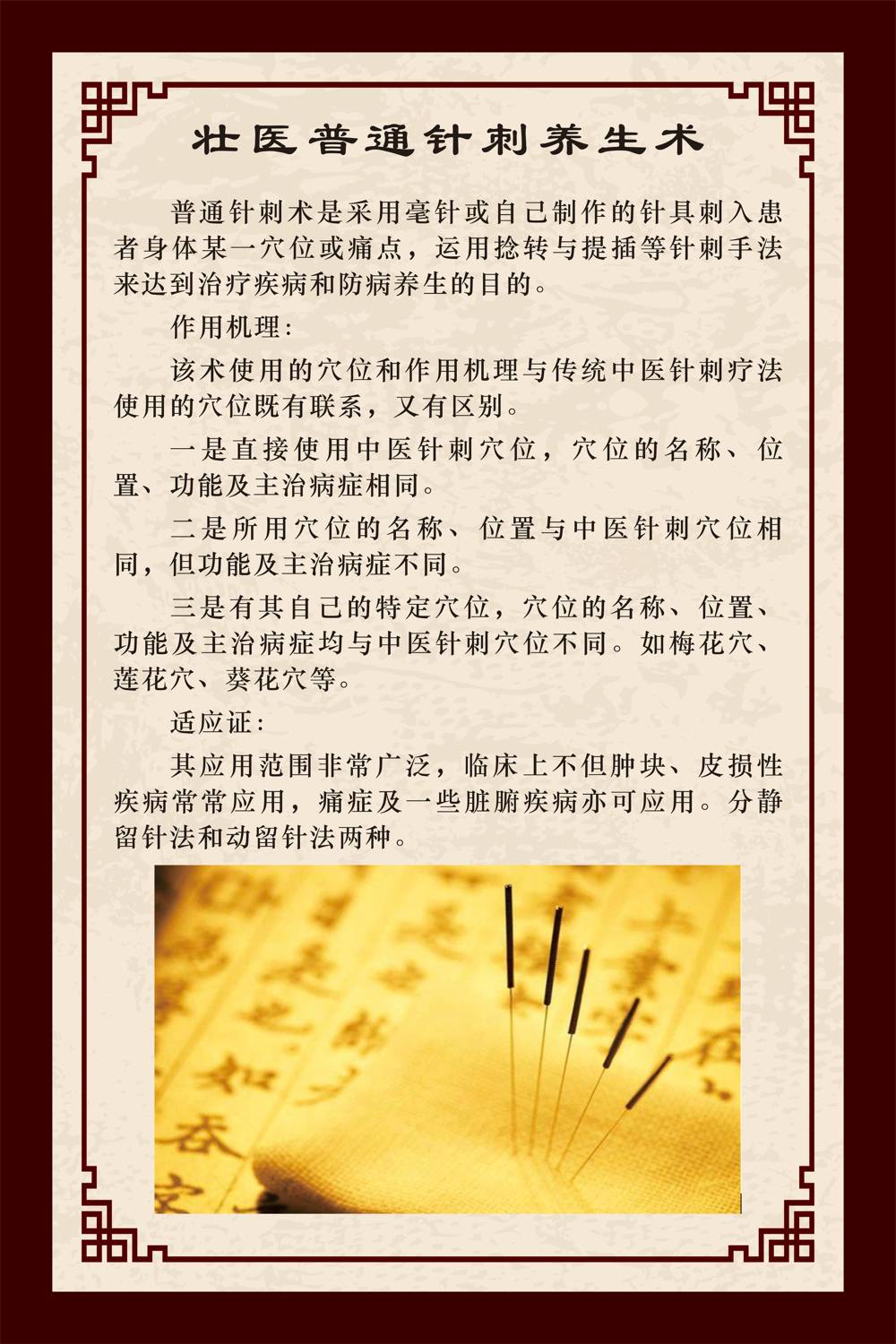 普通针刺